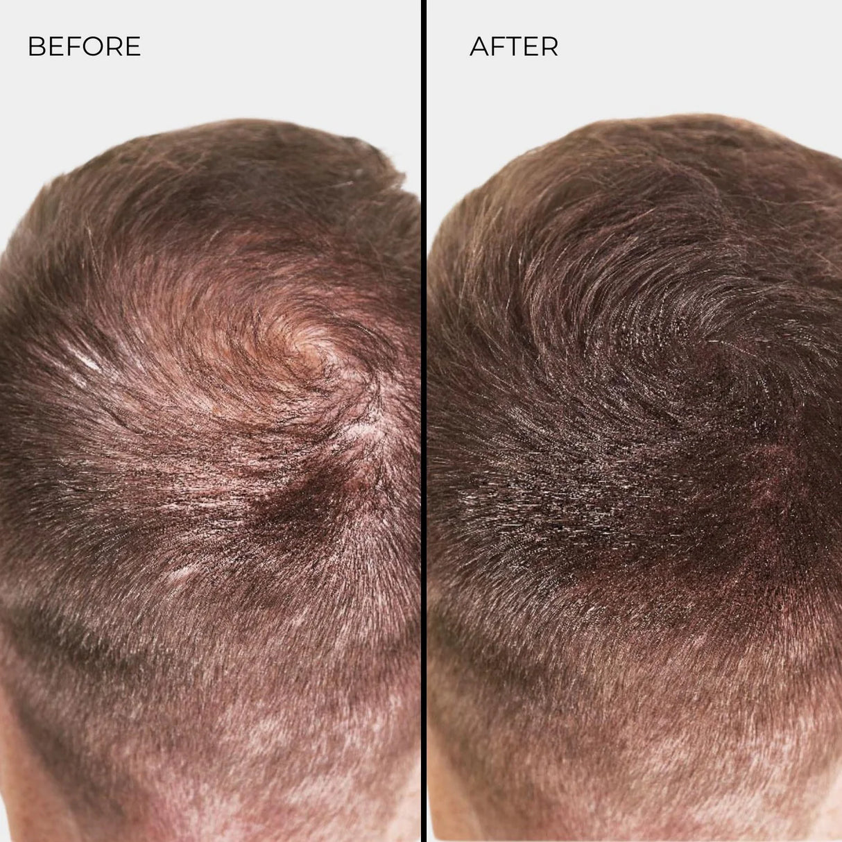 Nanogen juuste paksendamise kiud helepruun 15g