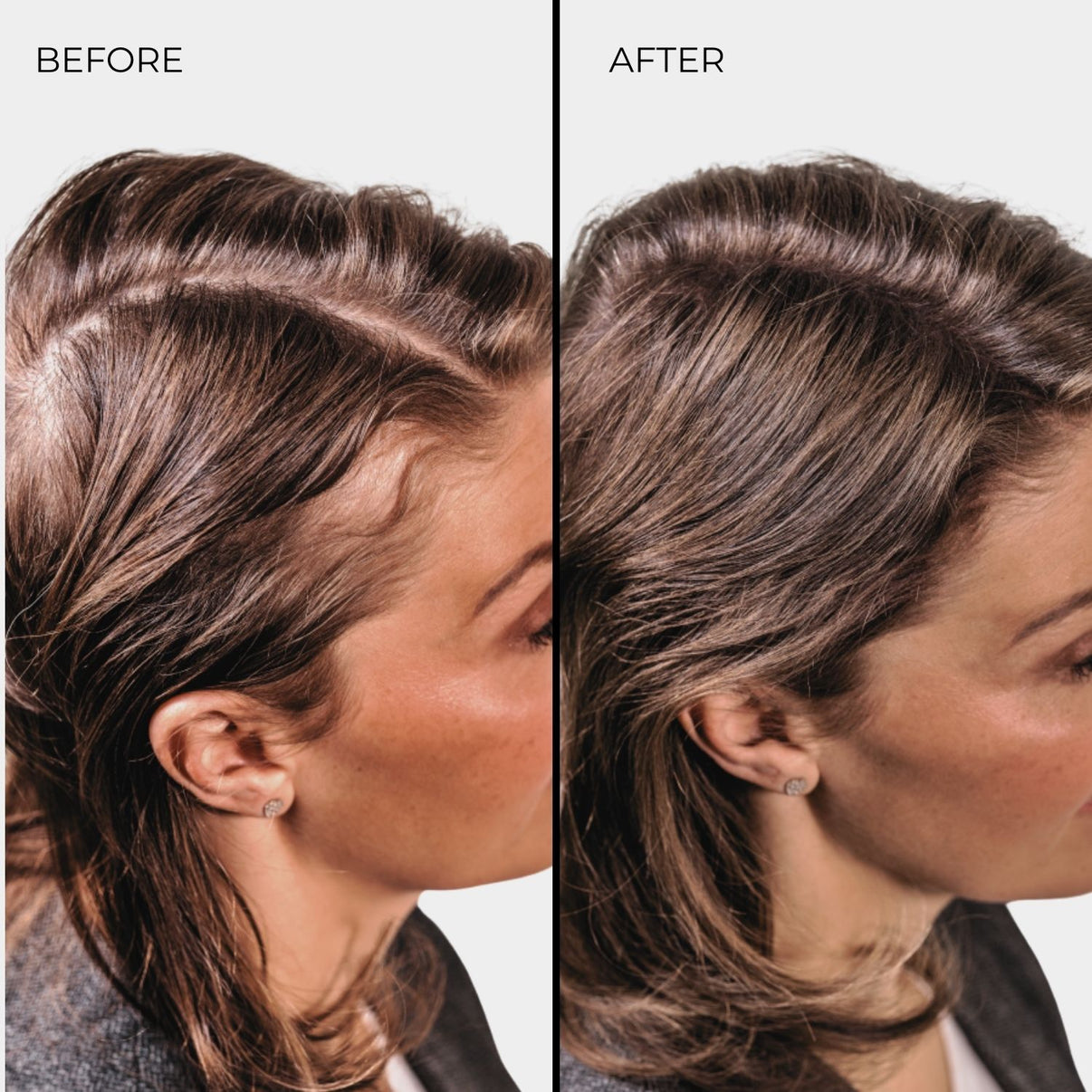 Nanogen Hair Thickening Fibre Light Brown 15g - BVShop