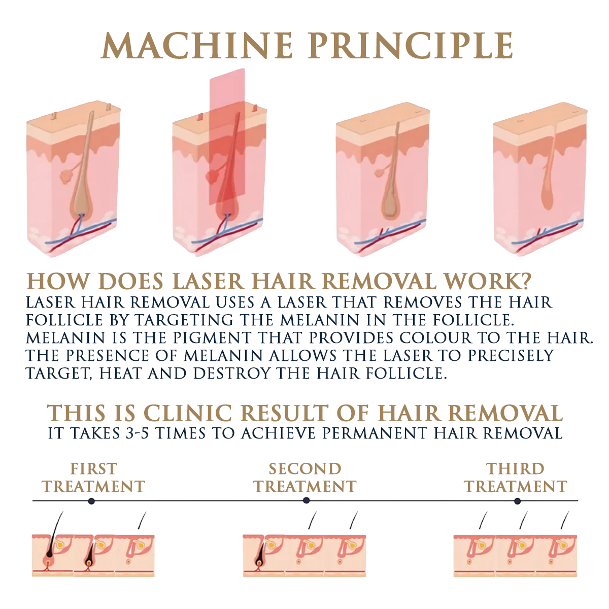 Skin Monarch Qantum Pro diood- ja pikosekundiline laser